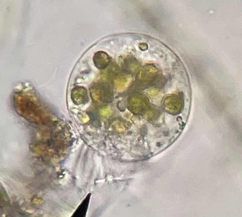  Ciliates (Class Spirotrichea) 
