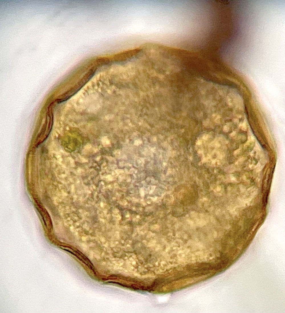   Amoeba  ( Family Arcellidae ) one of several microscopic observations in March. Photo by  Sam Kieschnick  