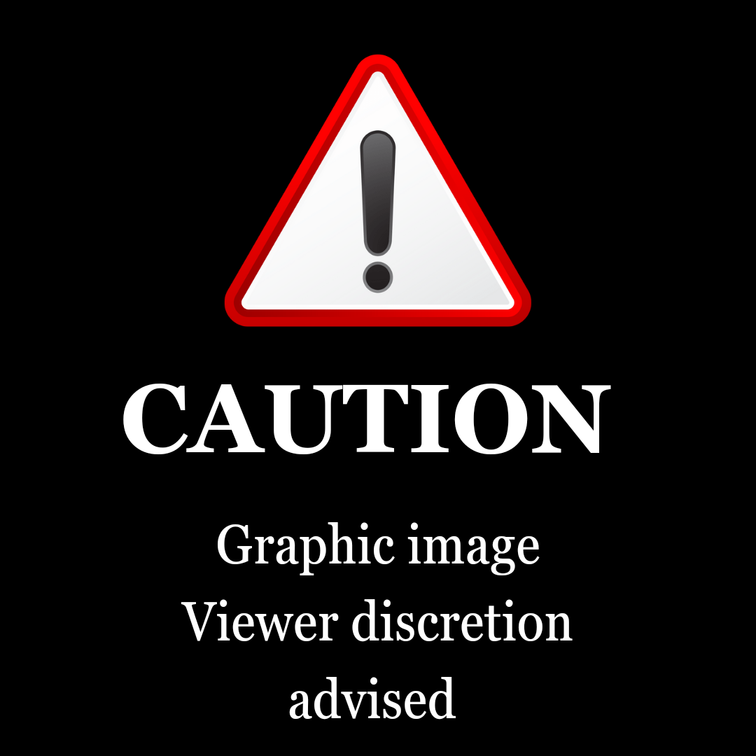 Graphic image Viewer discretion advised_20240520_030115_0000.png