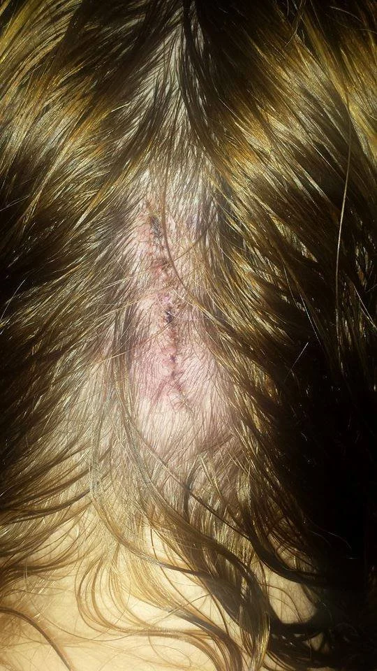 Small scar in the middle of a head with the hair parted
