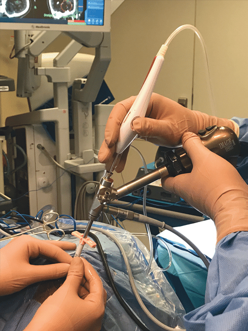 Endoscopic surgical instruments in use in an operating room