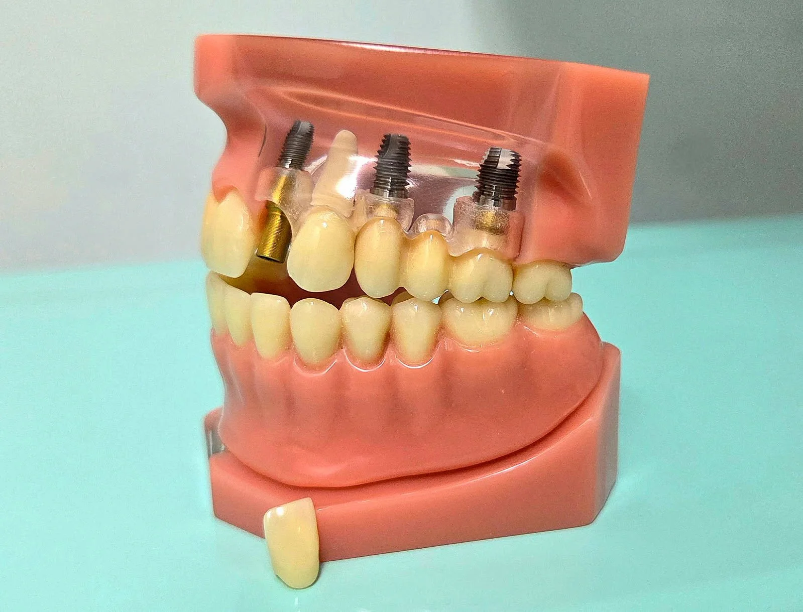 Modern building on green hillside with snow-capped mountains in the background under cloudy sky.