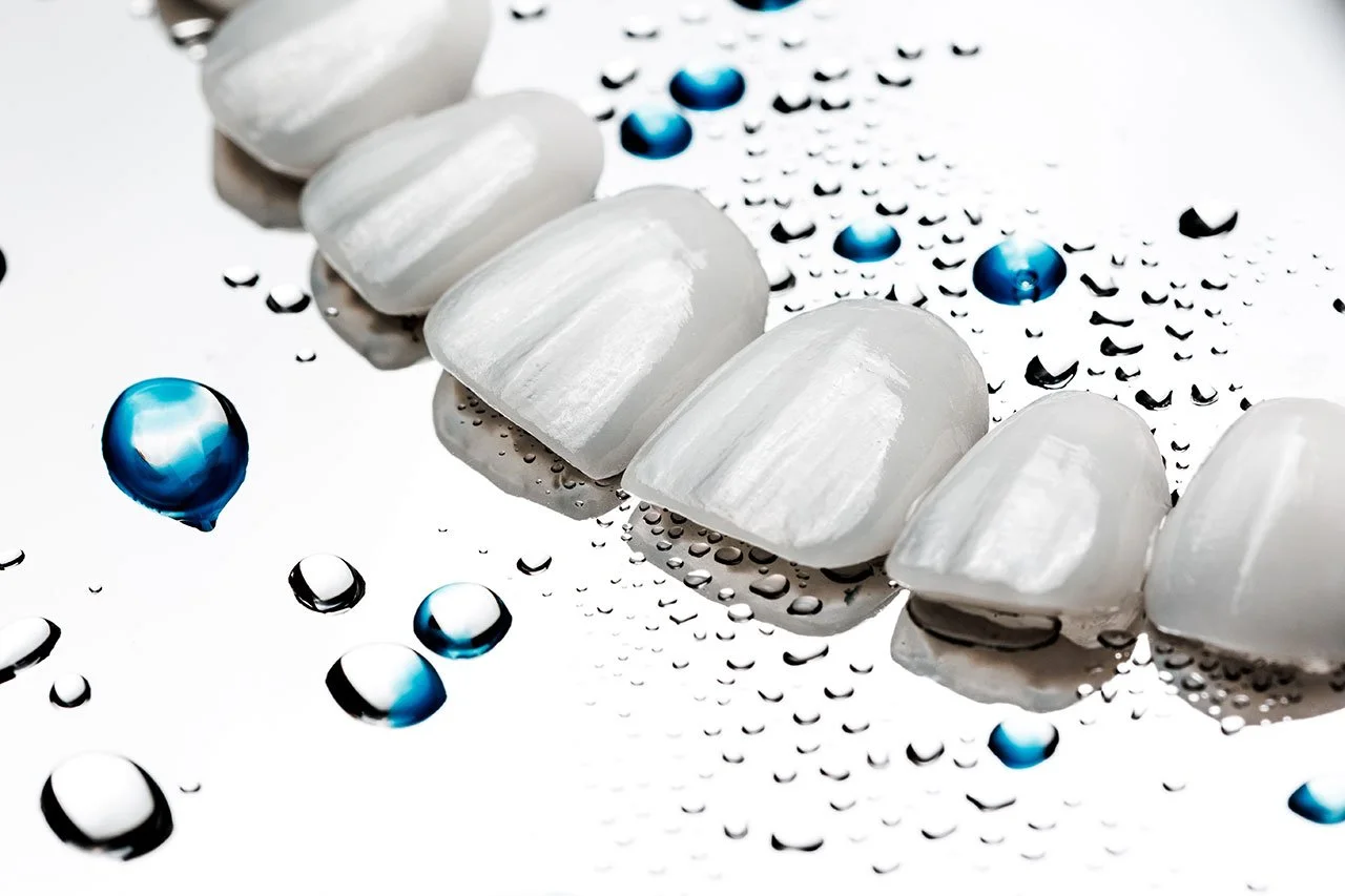 The Ultimate Smile Makeover In East Haven: Whitening, Veneers And Bonding Compared