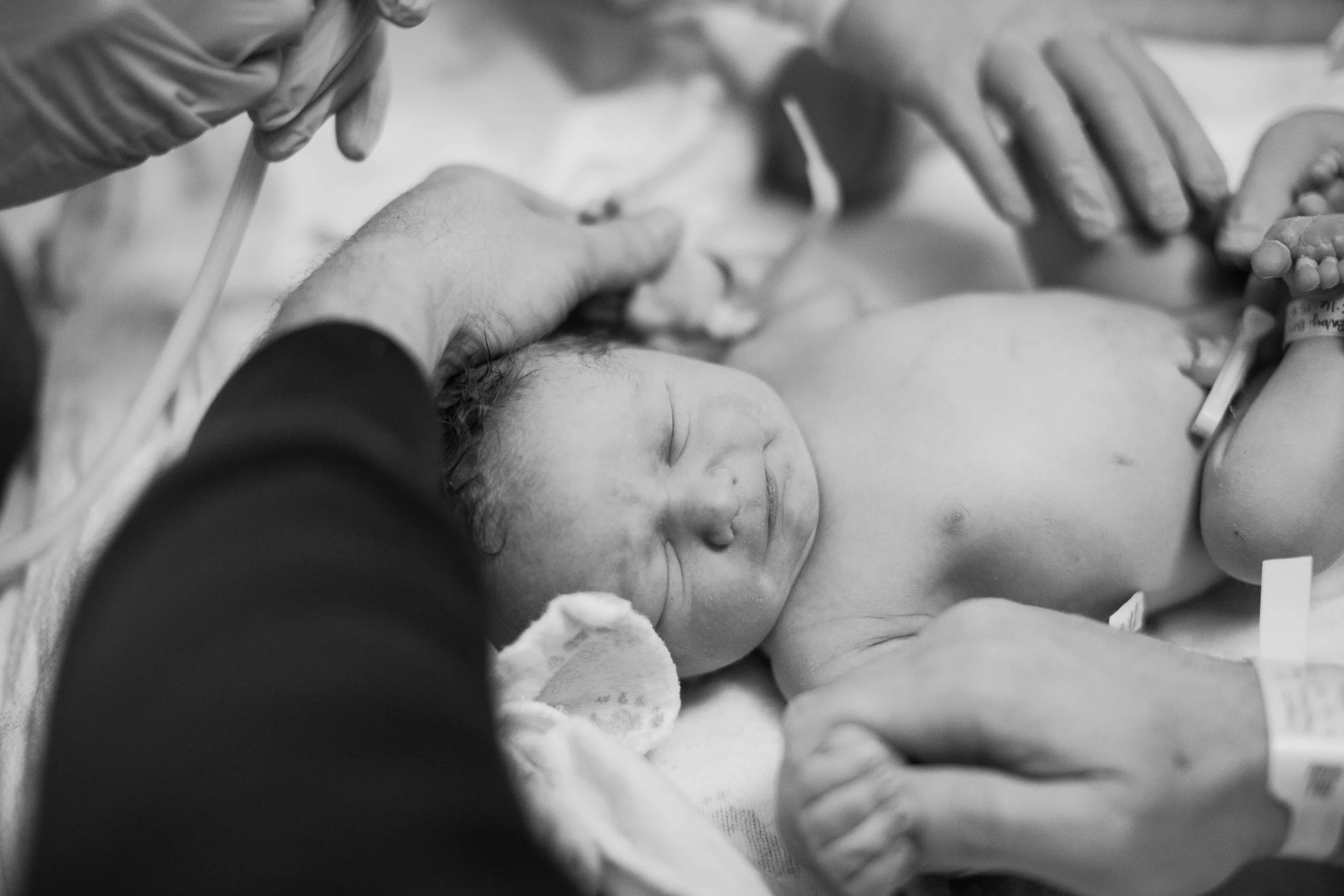 Congenital CMV (cytomegalovirus)