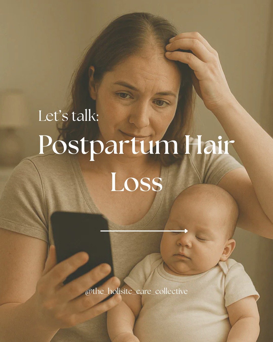 🧪 Science Sunday 👩🏽&zwj;🔬

Postpartum hair loss is a common physiological change after pregnancy.

Research suggests around 40&ndash;50% of women experience noticeable hair shedding after birth, often beginning 2&ndash;4 months postpartum.
During