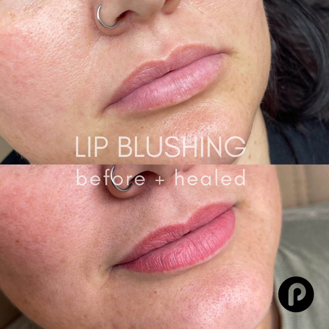 LIP BLUSHING BEFORE AND HEALED.png