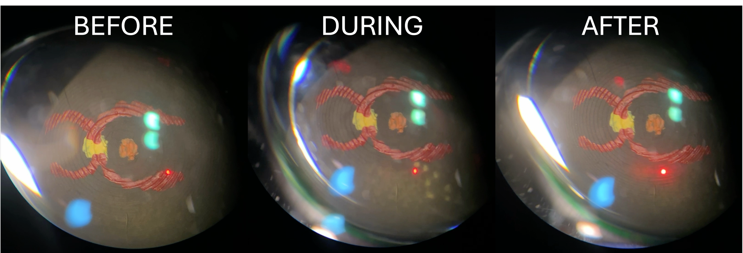 Close-up of a small spherical object showing the transition of a design from before, during, and after, with the design appearing to change through these stages, with the labels 'BEFORE', 'DURING', and 'AFTER' at the top.