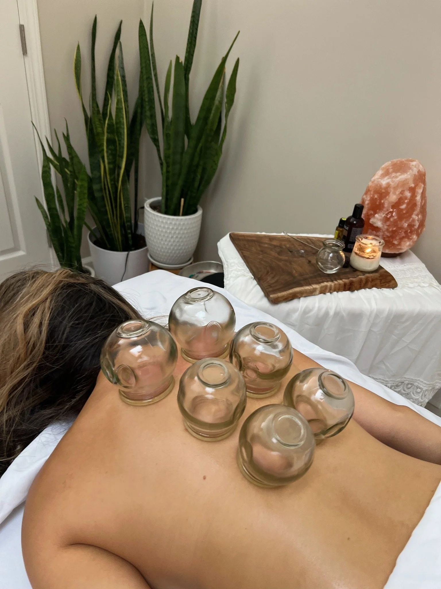 What Is Cupping Therapy? Benefits, Marks &amp; What to Expect