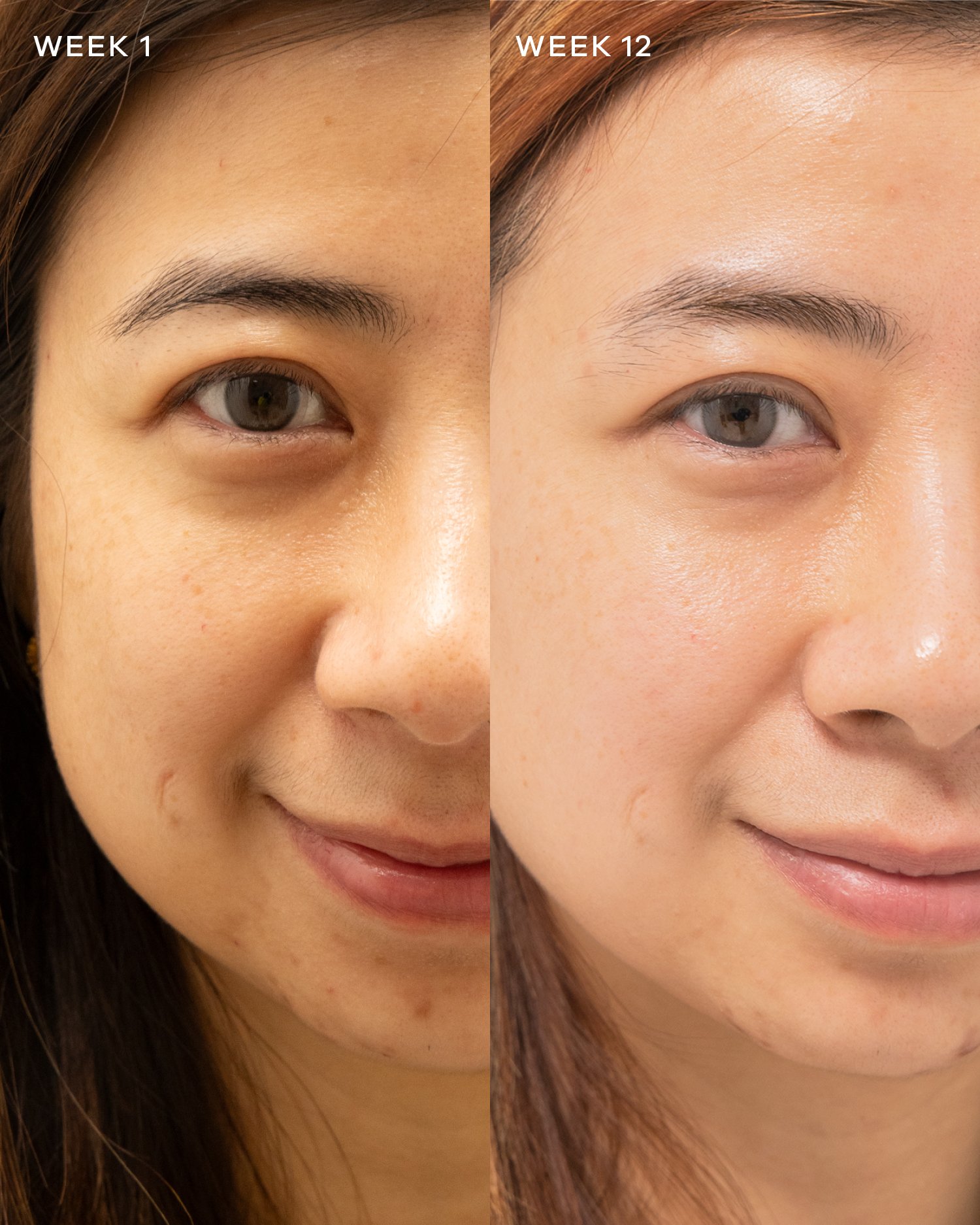 2-VidaGlow-Collagen-Liquid-Advance-Before&After.jpg
