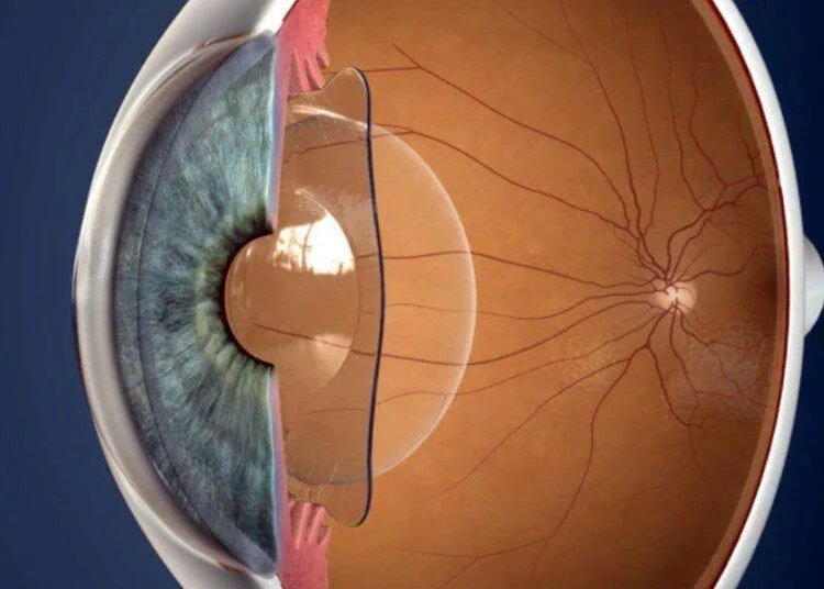 Diagram of Eye