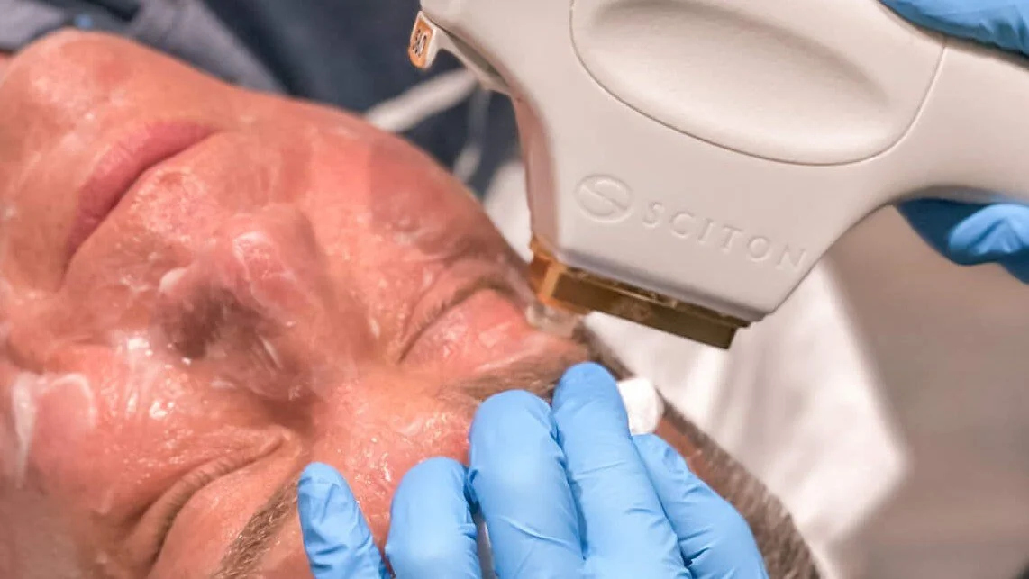 Patient Undergoing Dry Eye Treatment