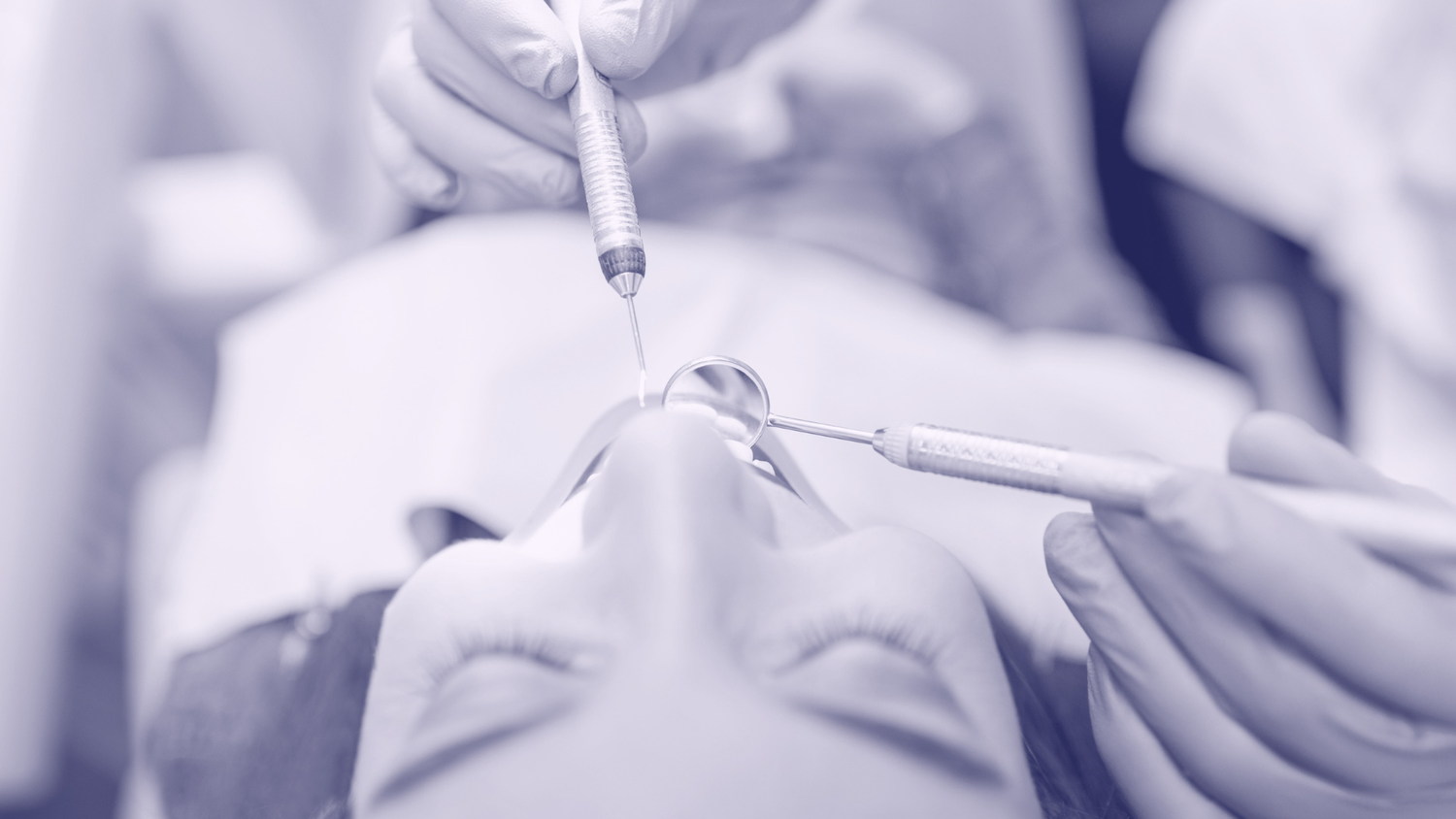 Dental Cleaning Guide — Harvest Dental Care