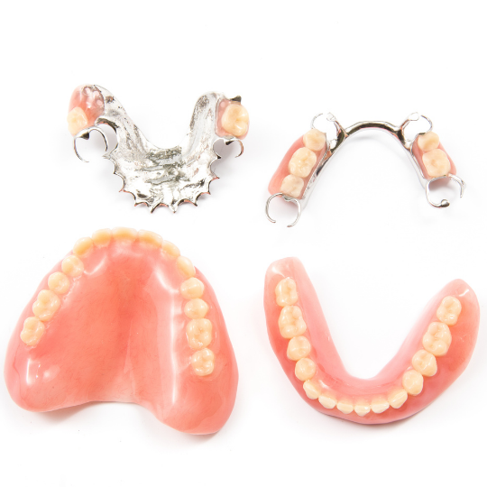 Close-up of a person's lower molar with a shiny metal dental crown.