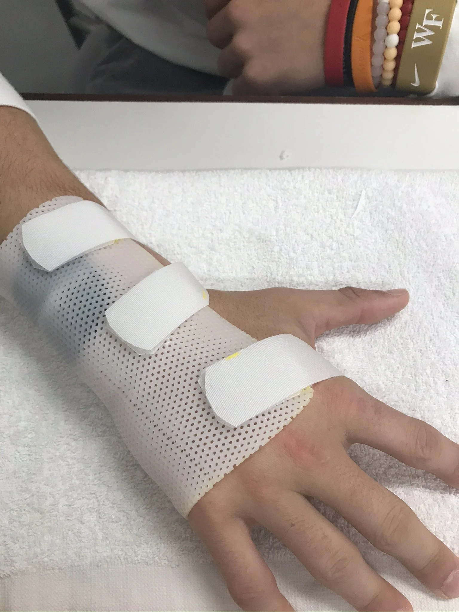 Protective Hand 2.JPG