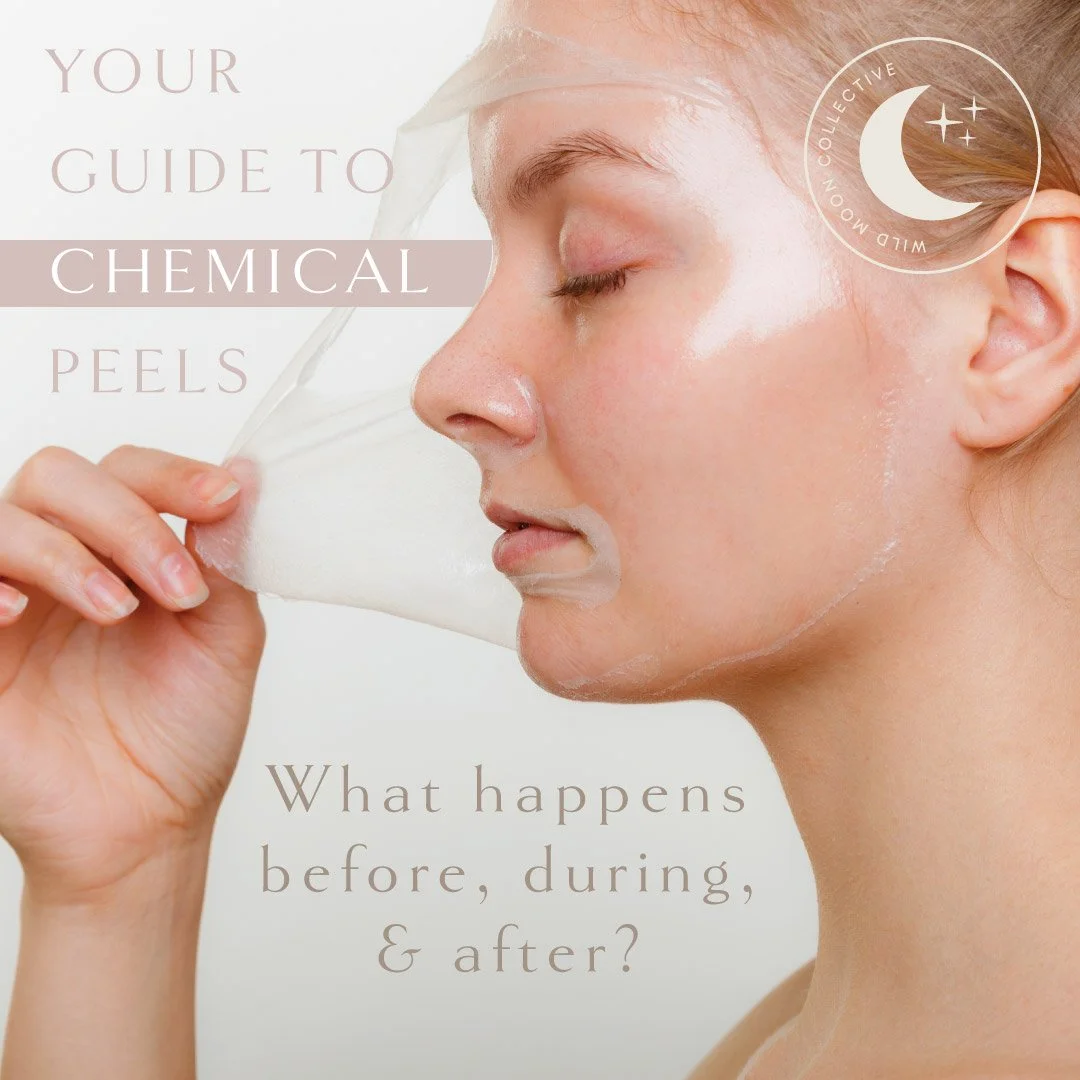 chemical peel treatments near me