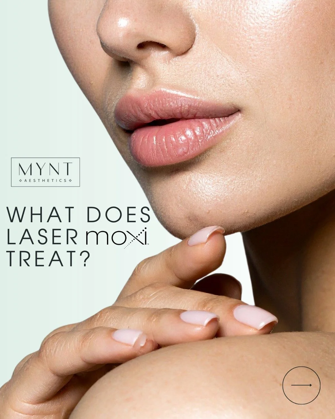 Sun damage? Uneven tone? Early signs of aging?

MOXI Laser targets:
✨ Sun damage
✨ Fine lines + early wrinkles
✨ Uneven skin tone
✨ Rough texture
✨ Pigmentation + melasma
✨ Preventative aging

The perfect treatment for glowing, refreshed skin with li