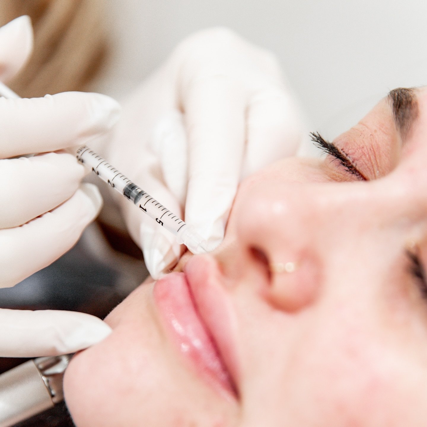 A little volume can make a beautiful difference. Softly enhanced lips with natural shape and refined definition.💉

#canvasskin #canvasskinnashville #canvasskimbrentwood #liptransformation #juv&eacute;derm