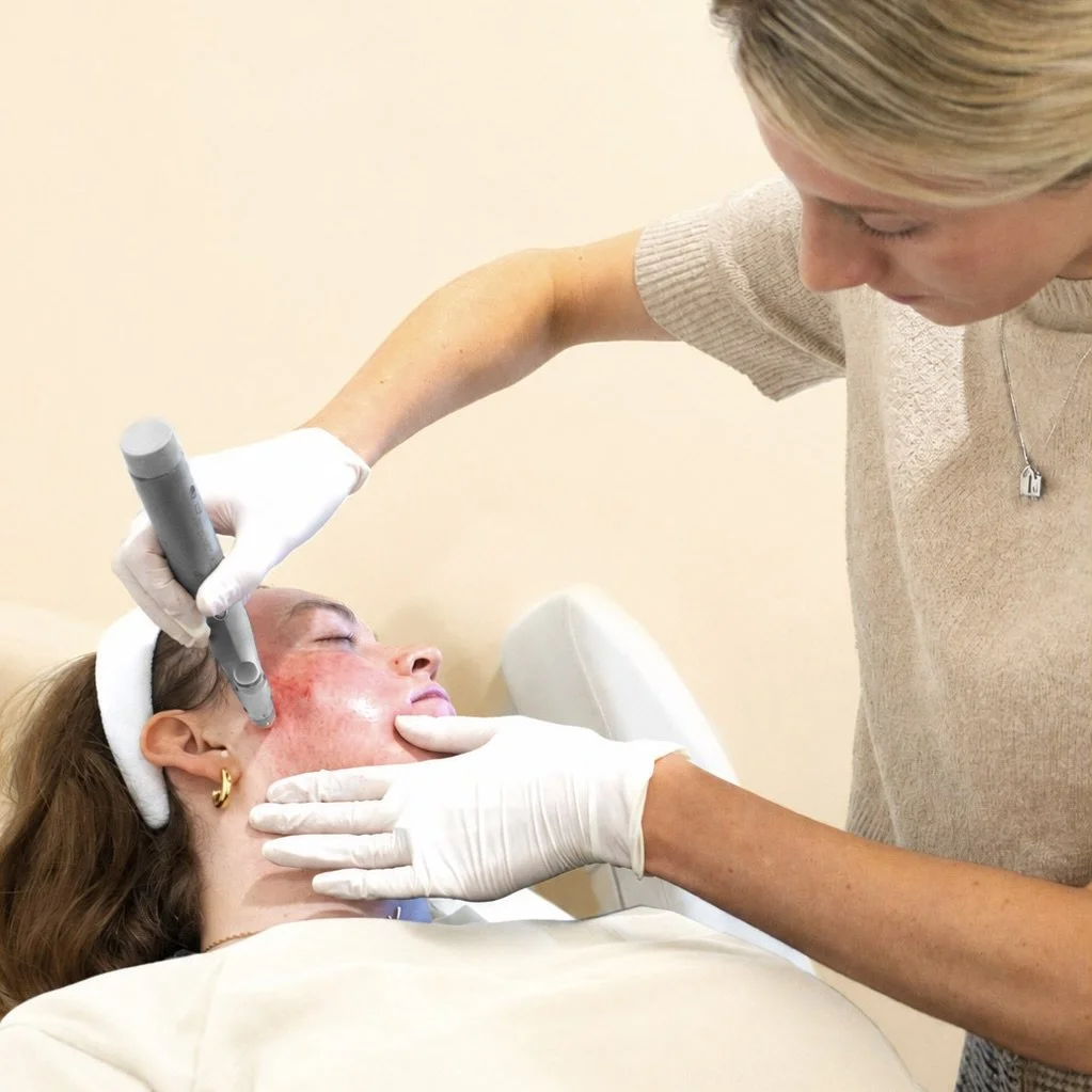 Why Microneedling Matters 