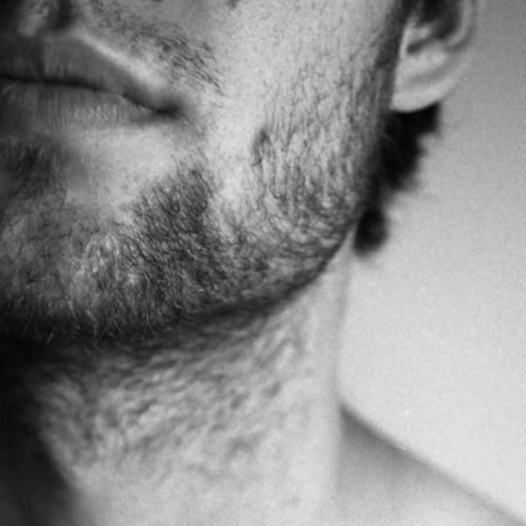 Acupuncture for Mens Fertility, Pain, Stress and Performance Support
