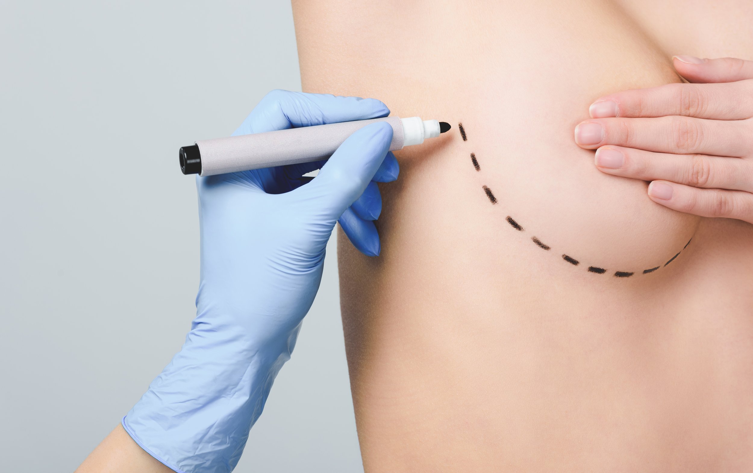 Getting Ready: Tips pre and post breast reconstruction