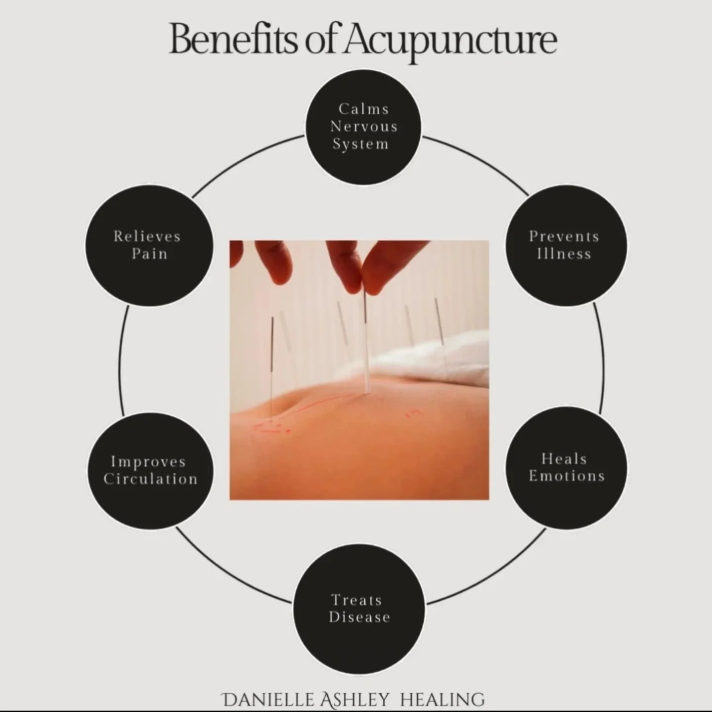 🈴 What has acupuncture helped you treat? 

Acupuncture is based on the principles of Chinese medicine, a medical system that has been practiced for thousands of years. Once a practitioner understands the key patterns of disharmony in a patient, they