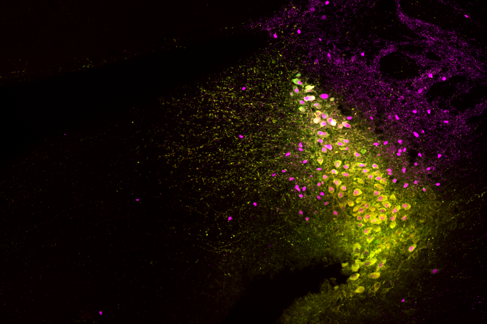 A fluorescence microscopy image of brain tissue showing clusters of neurons labeled in vivid yellow and magenta against a black background.