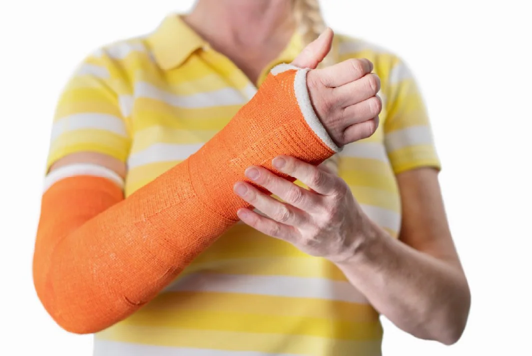 A blond haired person in a horizontally striped yellow and white shirt gestures with their hand, which is encased in a bright orange cast. The individual's thumb is raised in a gesture.