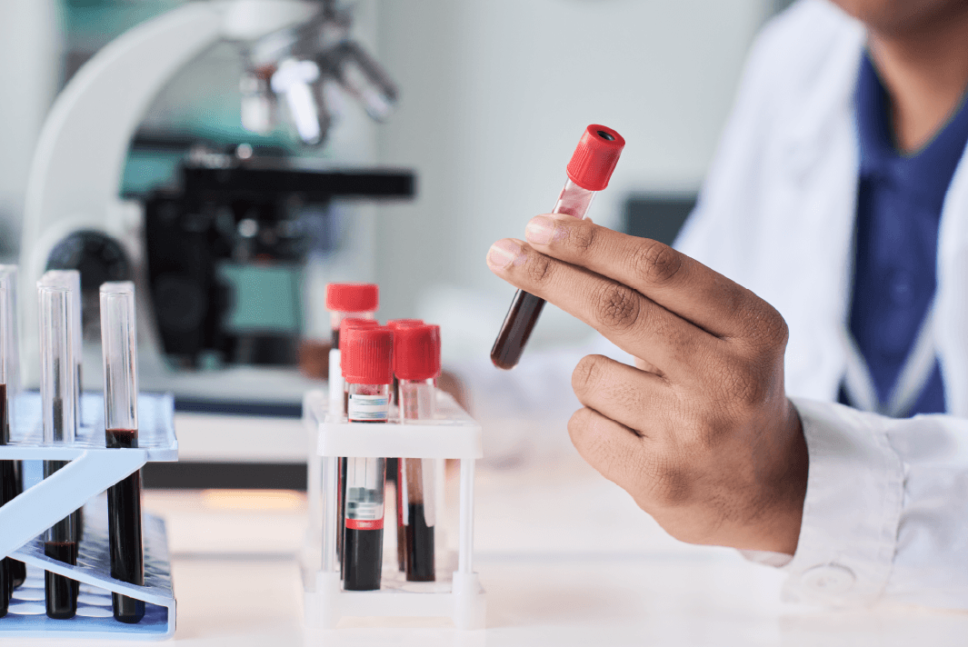 A Blood Test for Alzheimer’s?