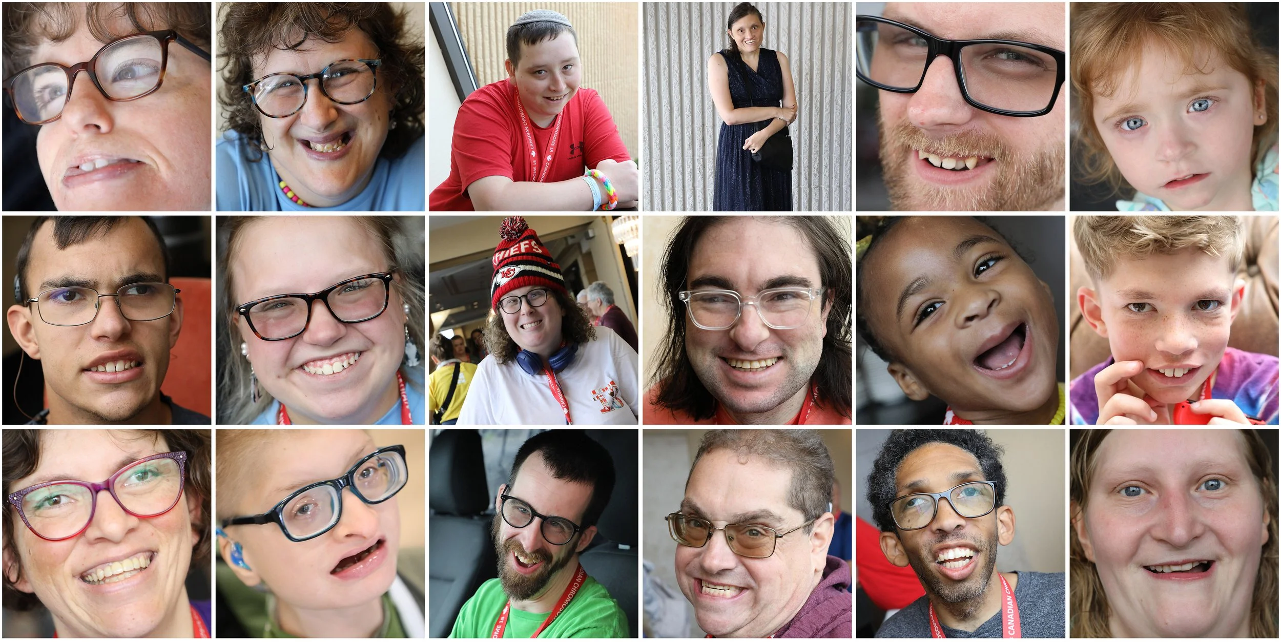 A collage of the many faces of Chromosome 18 conditions.