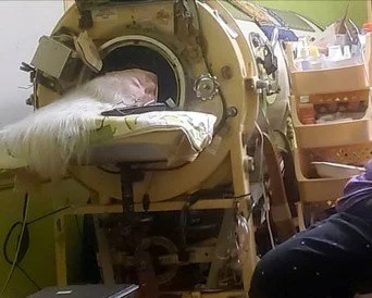 An older Lillian, with long locks of white hair, rests in her iron lung