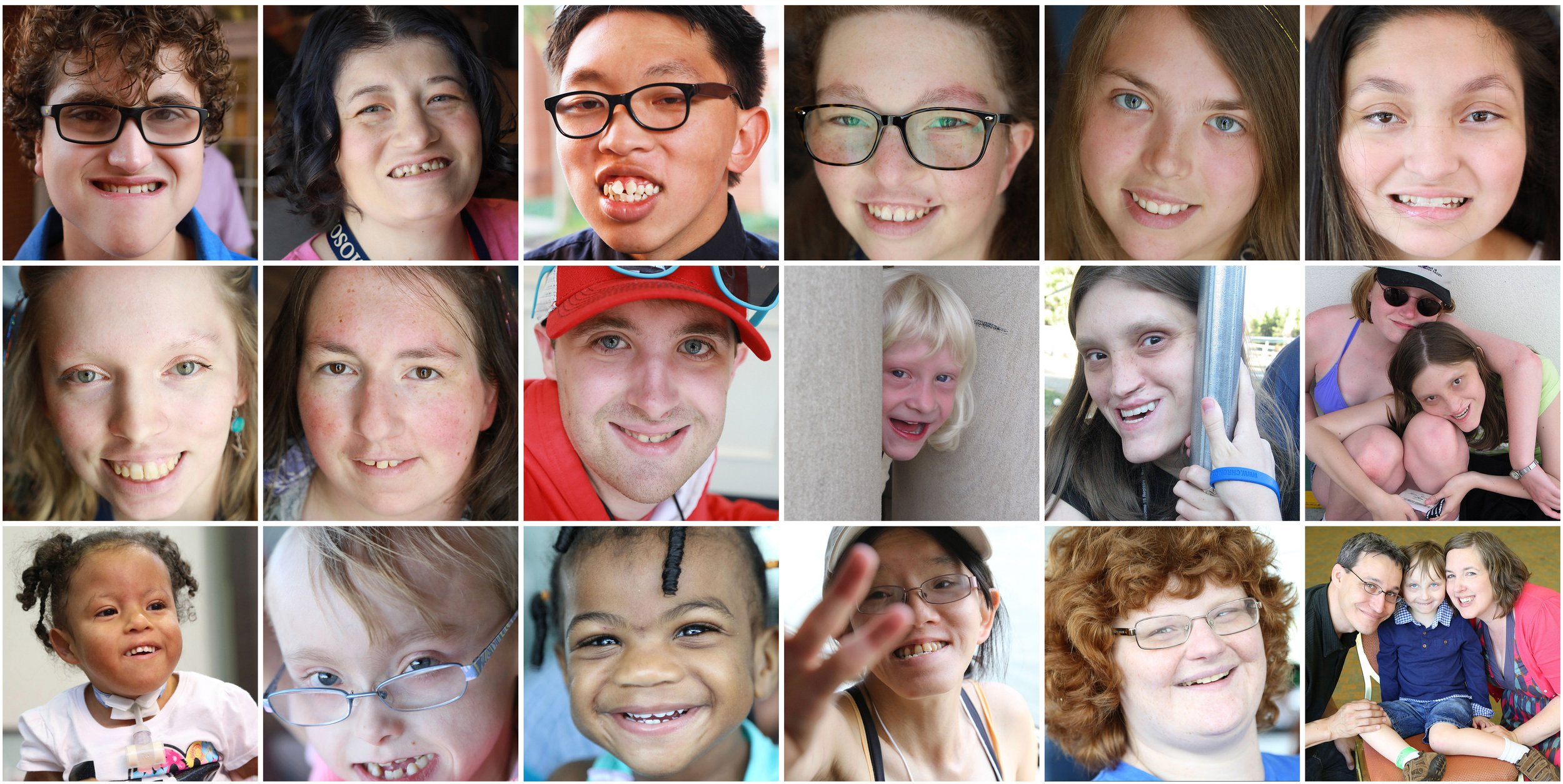 A collage of the many faces of Chromosome 18 conditions.