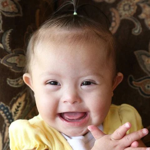 A cute photo of a smiling baby girl with Down syndrome.