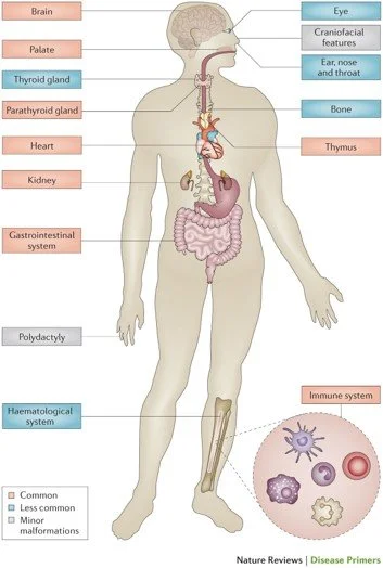 Diagram of the human body and the regions affected by q22 deletion
