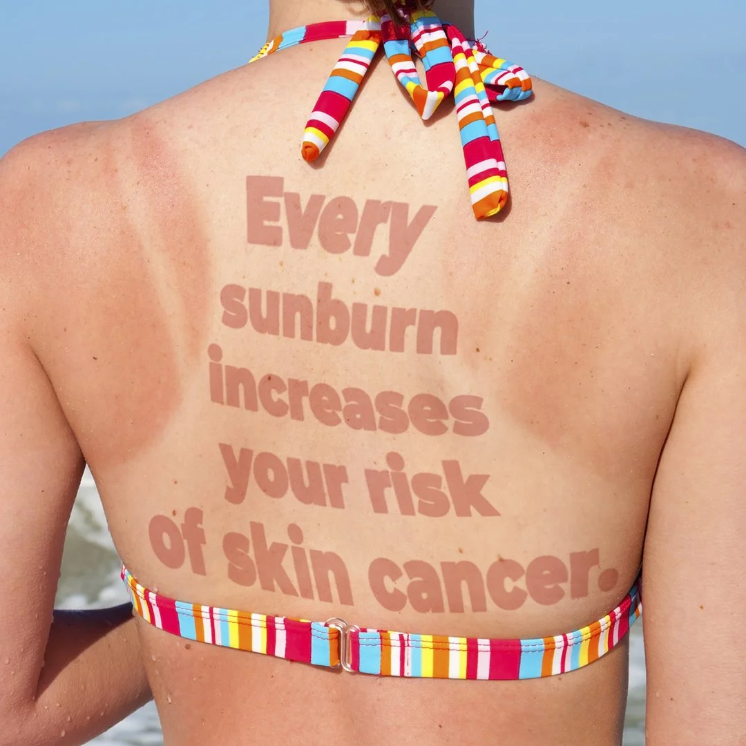 Saskatchewan Cancer Agency - Sun Smart Campaign
