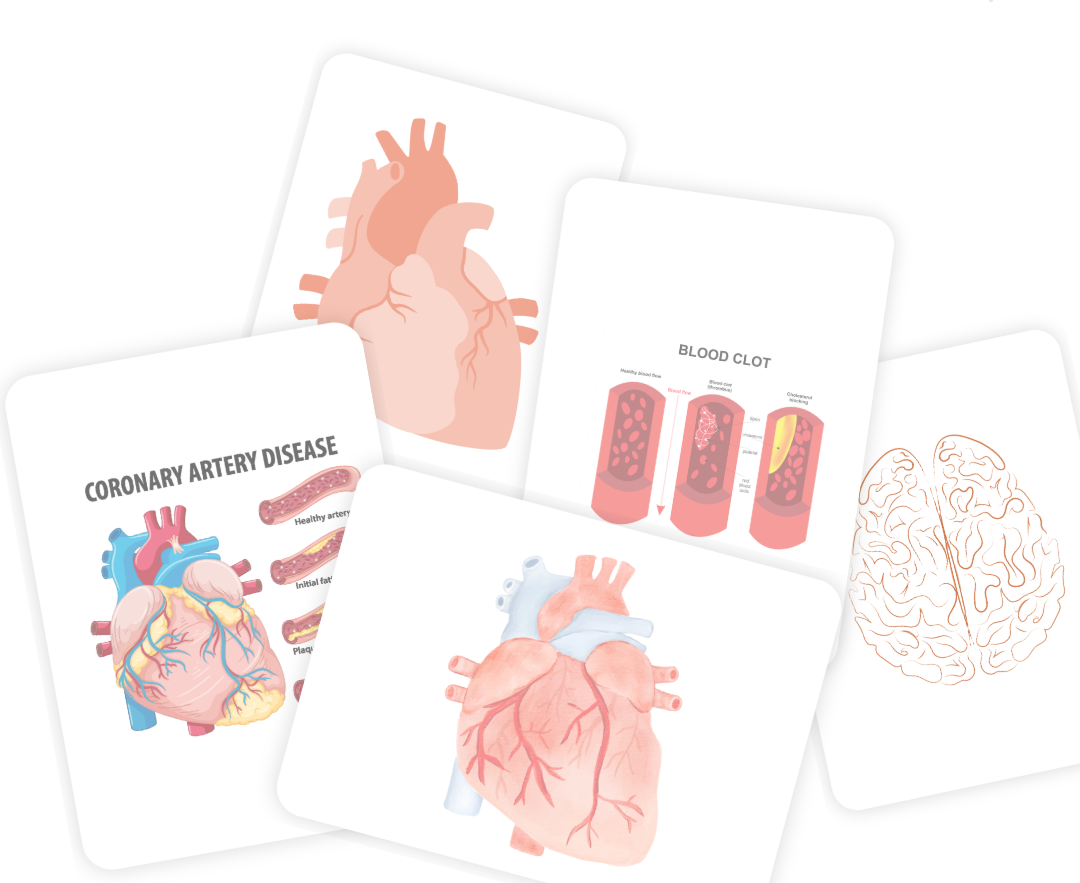 Medical educational illustrations of the heart, blood clots, and brain, including diagrams of coronary artery disease, blood clot formation, and brain anatomy.