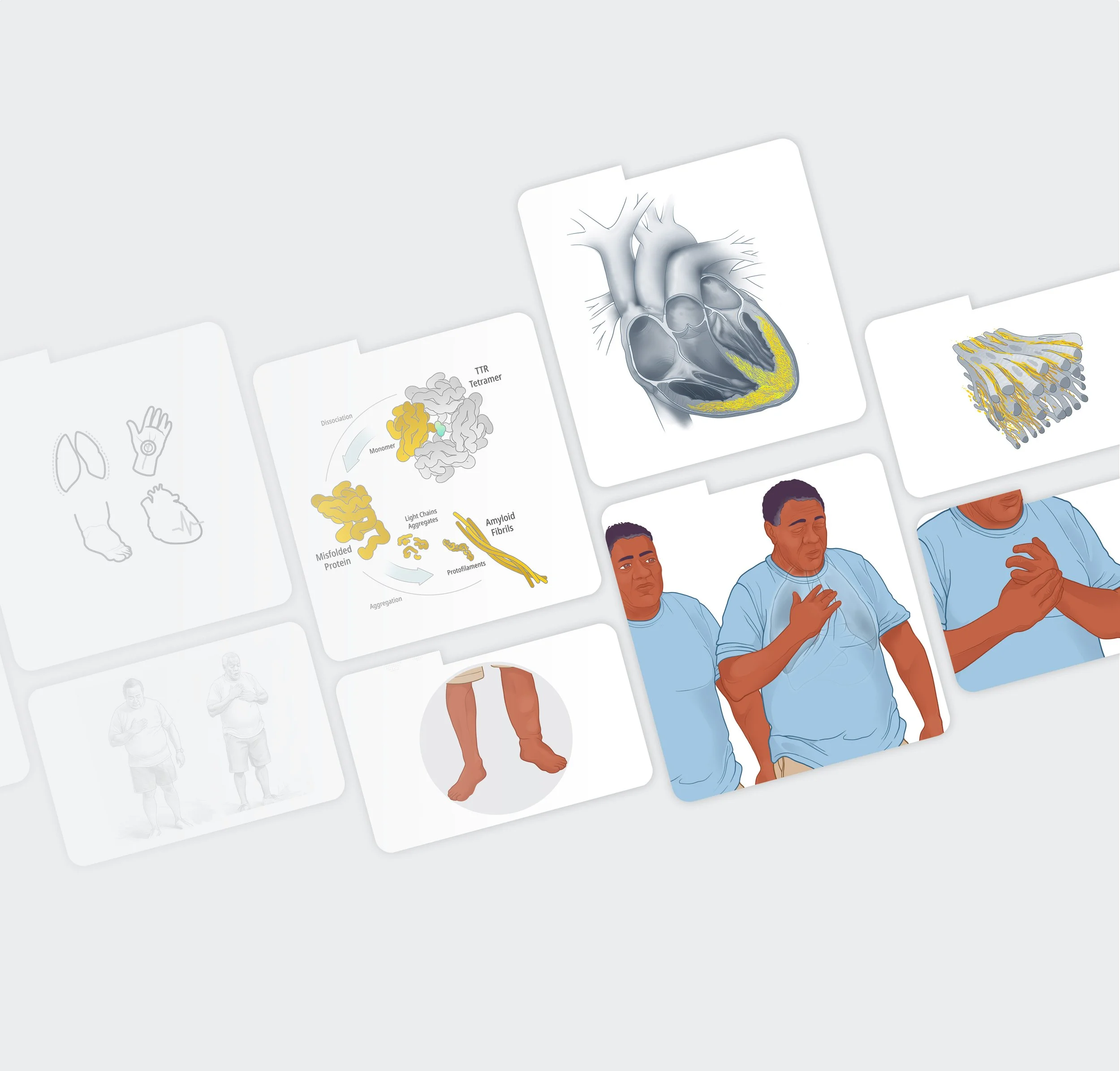 Educational scientific illustration of symptoms and anatomy of ATTR-CM rare condition, with detailed diagrams and labeled parts.