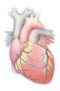 A medical illustration of a human heart showing internal chambers and blood vessels.