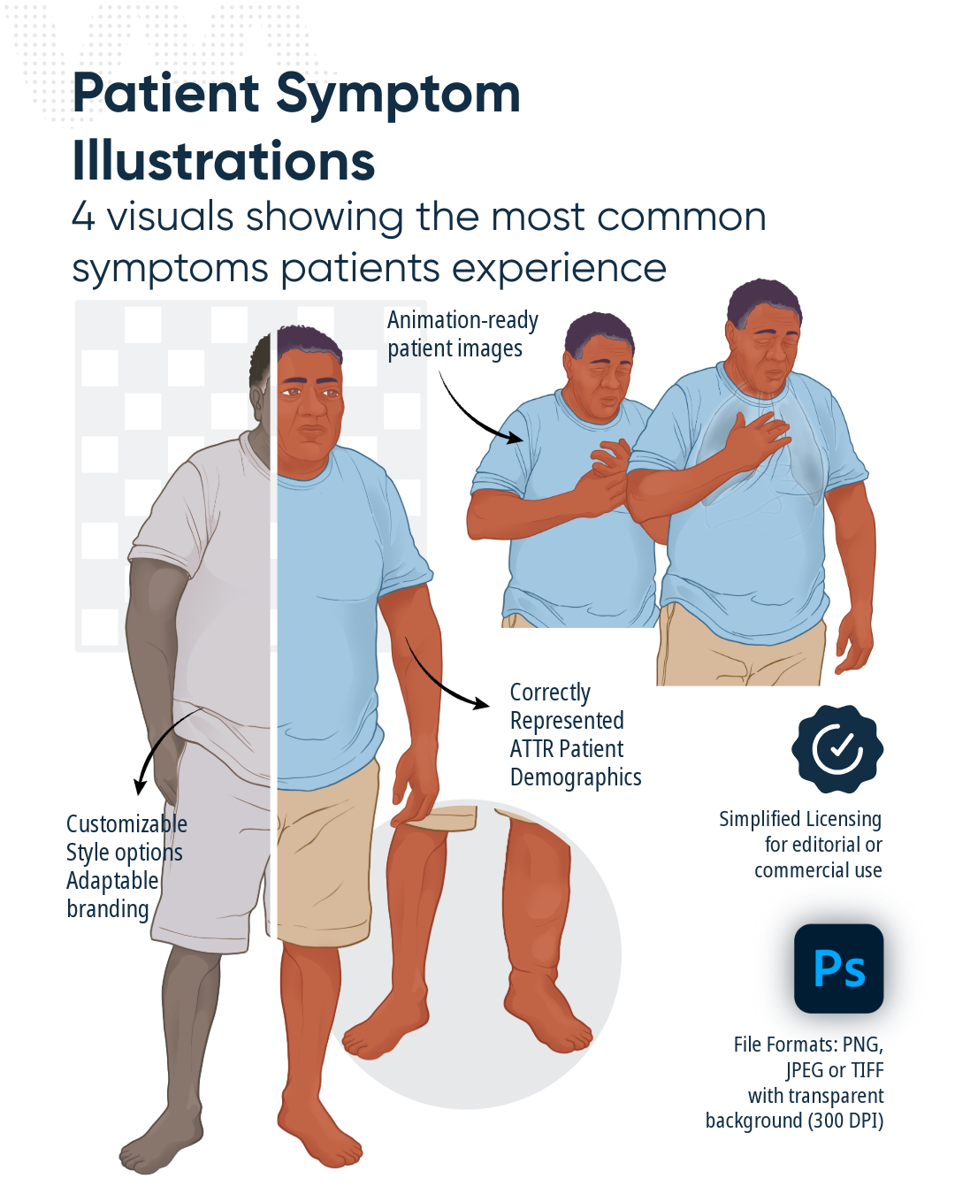 An illustrated guide showing a person experiencing symptoms of a stroke, with four images: the first depicts the person with a drooping face, weakness on one side, and arm weakness; the second shows the person with facial drooping and arm weakness; t