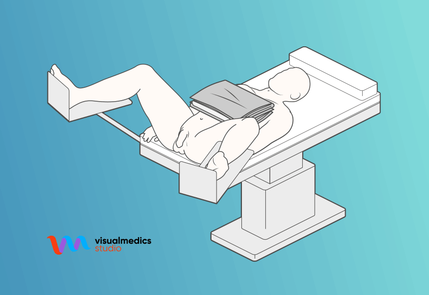A line drawing of a person lying on a medical exam table with a medical device or tray resting on their chest, against a blue background, with a small logo in the bottom left corner reading 'visualmedics studio.'