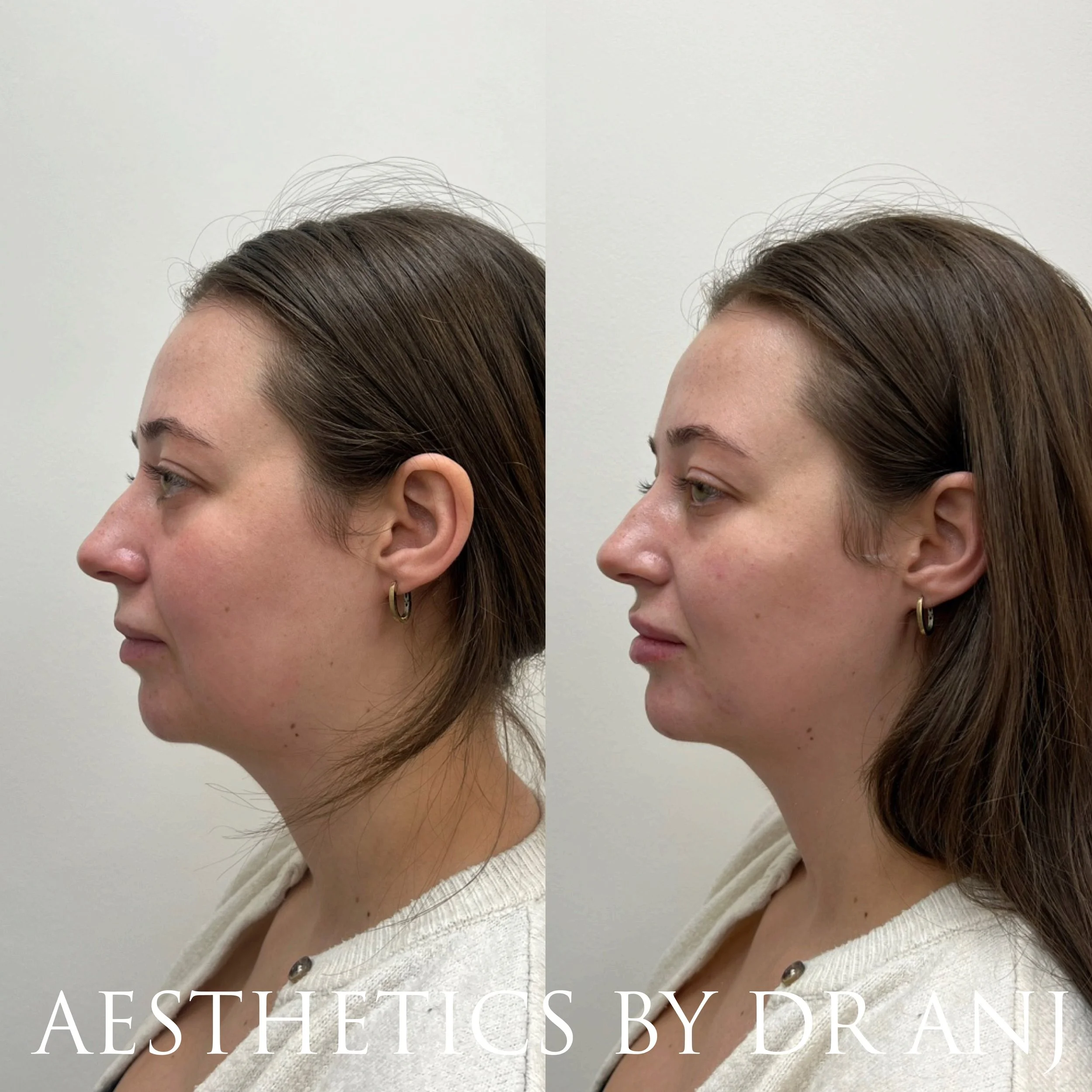 A2433909-D362-4E07-8CBC-F81419457CF3 2.JPEG