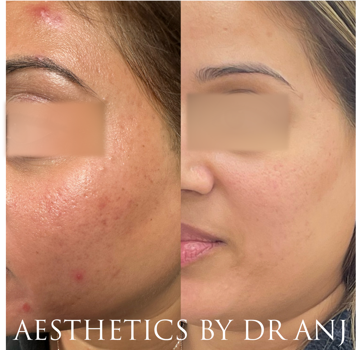 F89684B6-A0DF-42FD-98C0-10998323ACBD 2.PNG