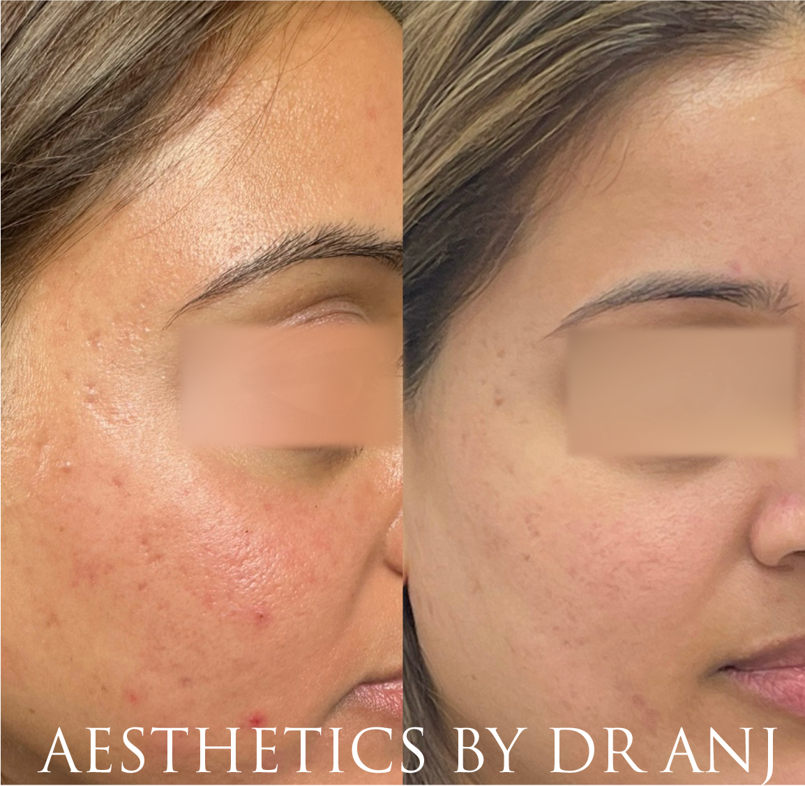 F3223674-CDBD-4540-B14E-589B46C8B49A 2.PNG