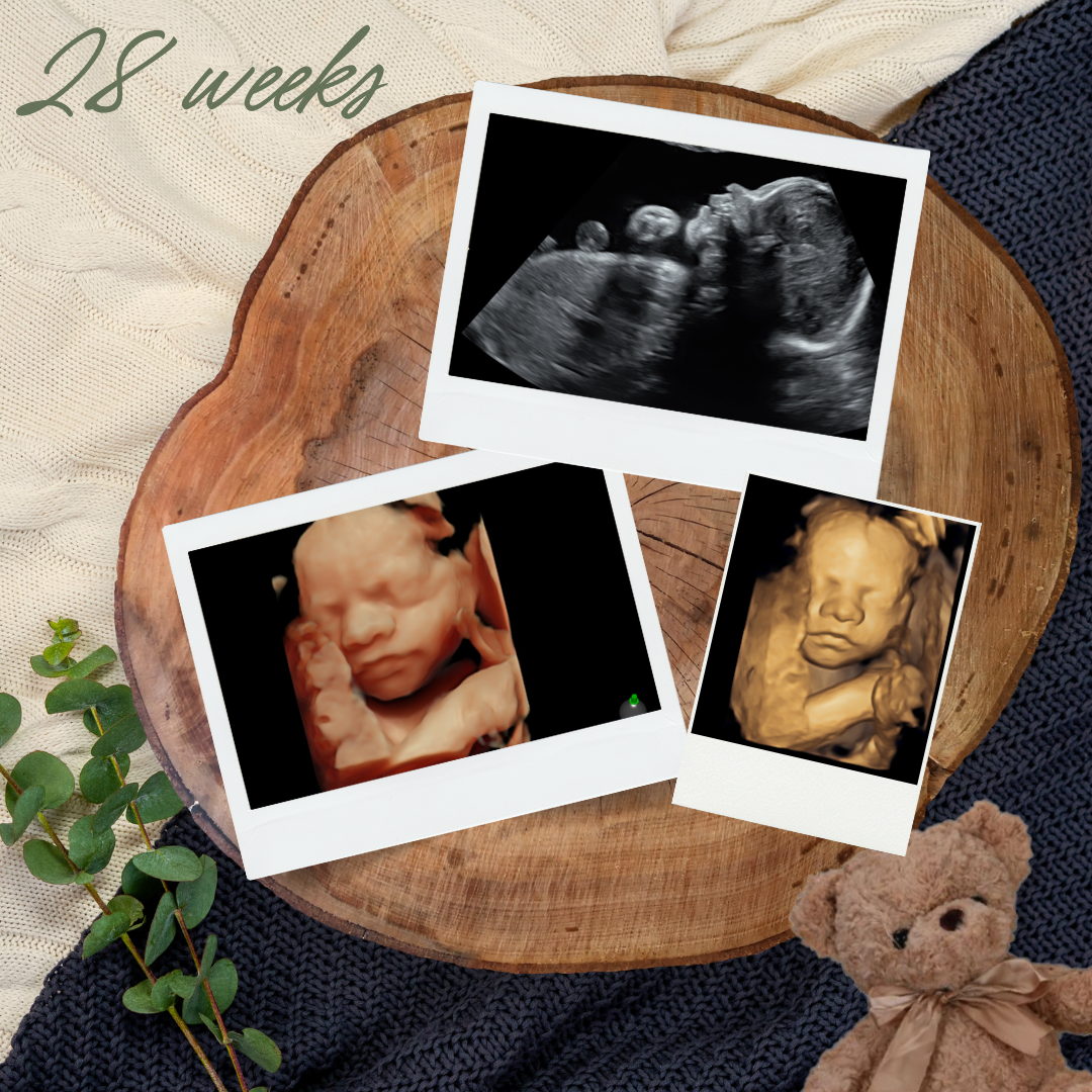 28 weeks.png