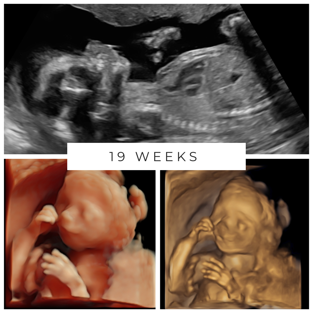 19 Weeks.png