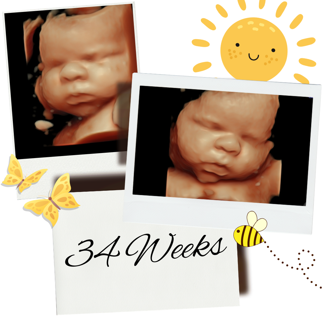 34 Weeks.png