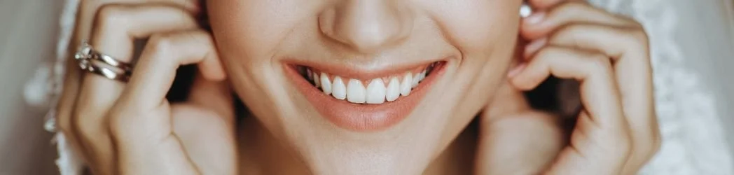 ¿Cómo mantener la sonrisa perfecta?: cuidado dental y tips para fotos impecables