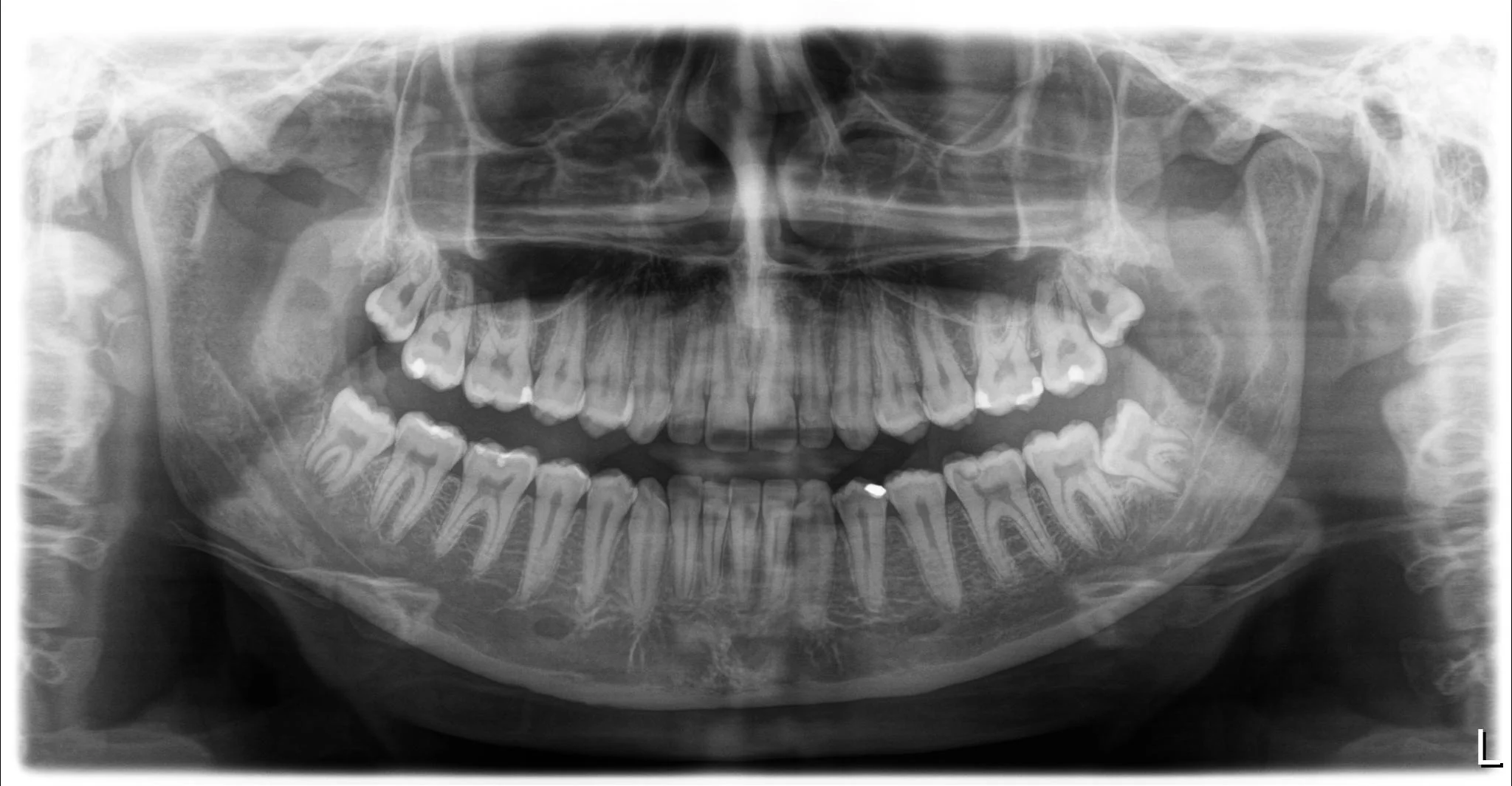 Demo_Patient_Light box(1)_Panoramic_20150118_132725.jpg