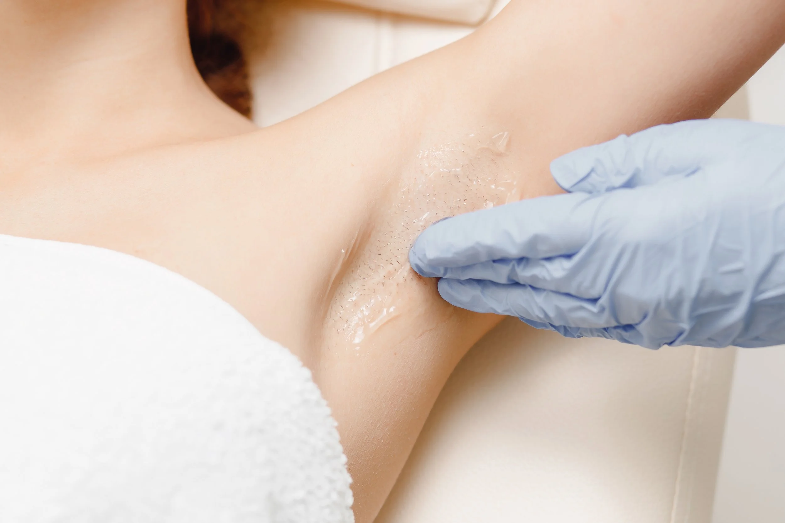 Armhålan stryks med gel innan skonsam behandling med IPL för hårborttagning