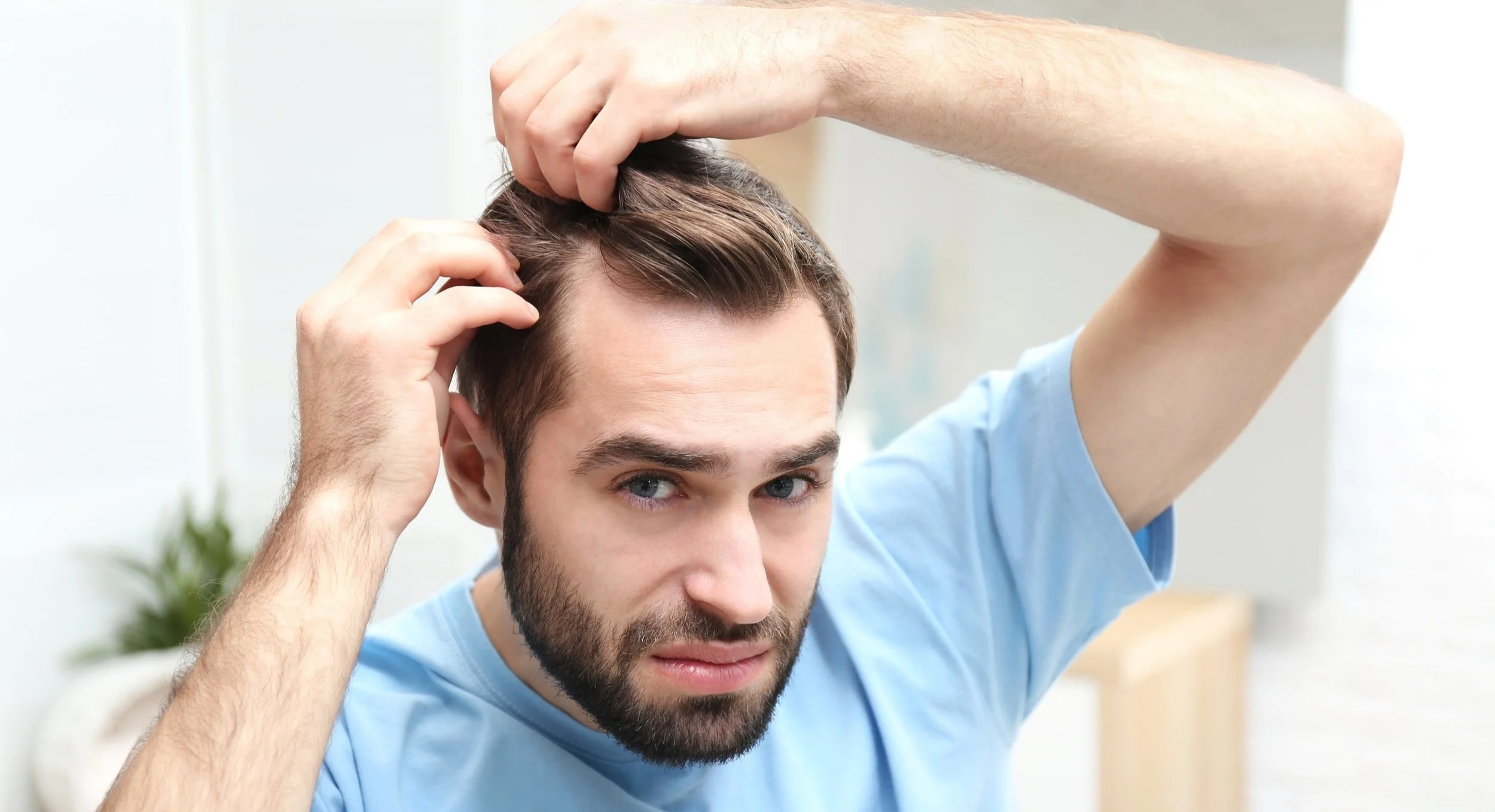 Man som besväras av håravfall innan hårstimulerande behandling med laser