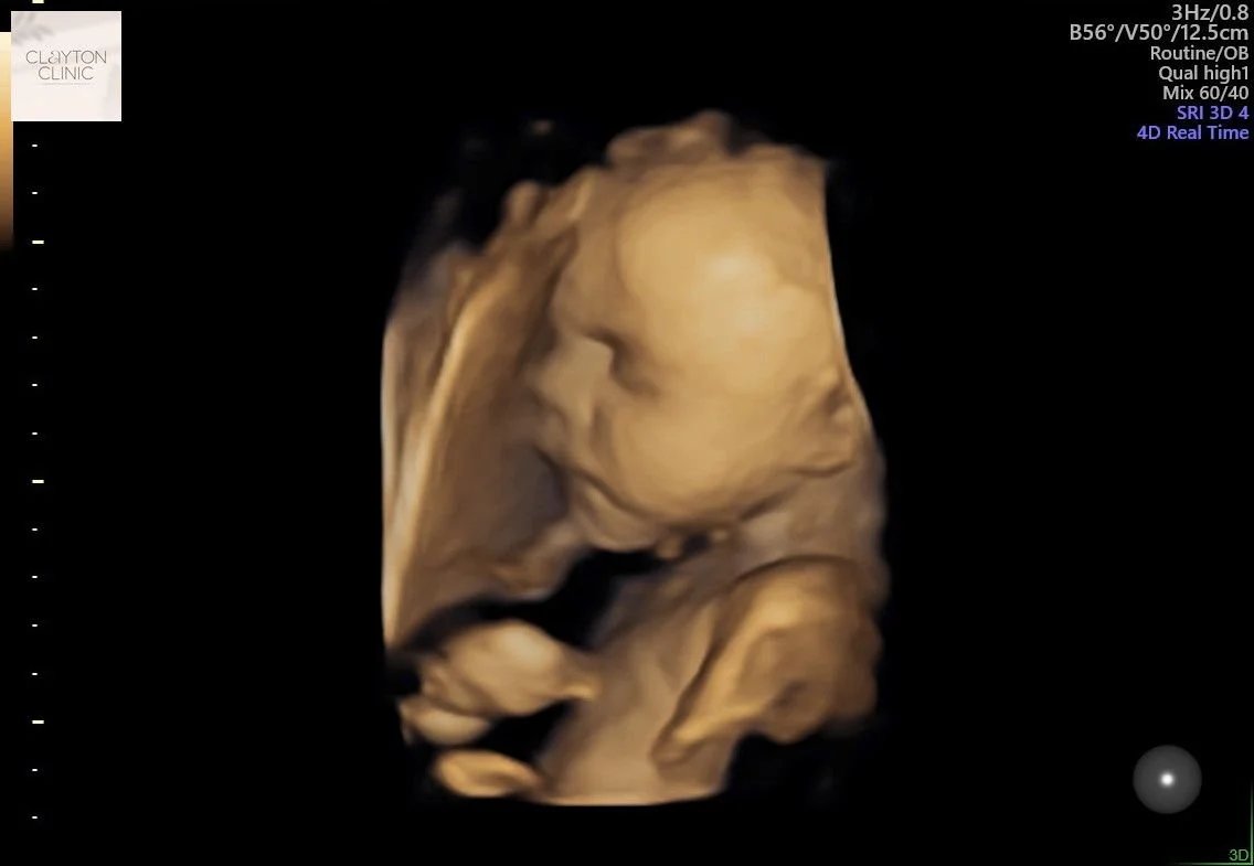 WhatsApp Image 2023-05-27 at 14.57.32.jpg